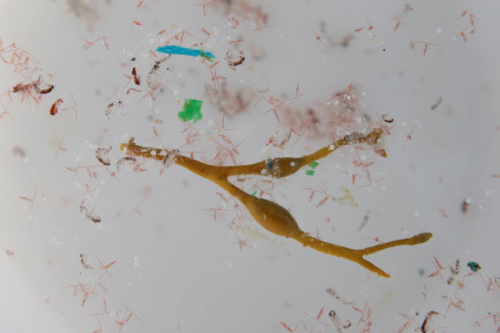 Echantillon de plastique où s'est accroché du plancton (Photo A. Deniaud-Garcia Tara Expéditions) Echantillon de plastique où s'est accroché du plancton (Photo A. Deniaud-Garcia Tara Expéditions)